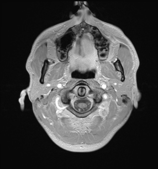 Click on the Serie image to view the images of RANDOM ANYONE