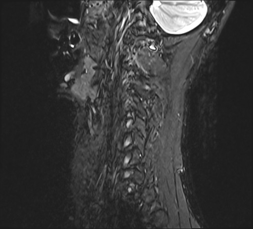 Click on the Serie image to view the images of RANDOM ANYONE