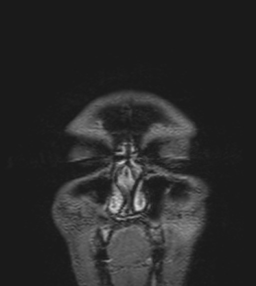 Click on the Serie image to view the images of RANDOM ANYONE