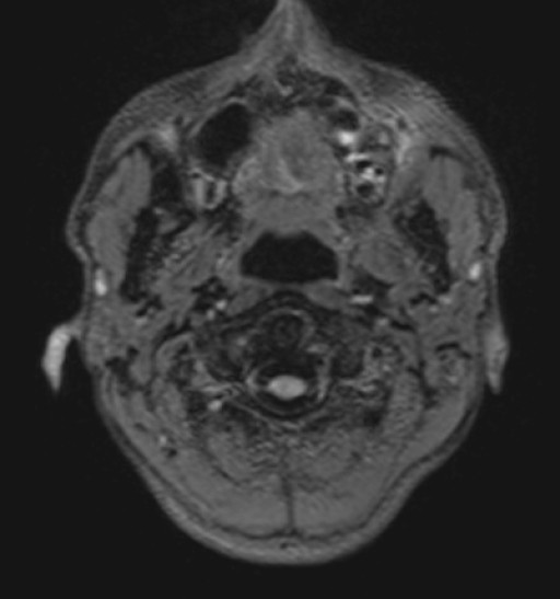 Click on the Serie image to view the images of RANDOM ANYONE