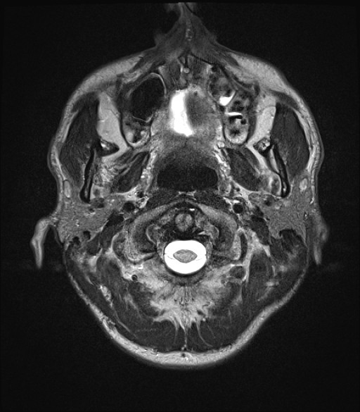 Click on the Serie image to view the images of RANDOM ANYONE