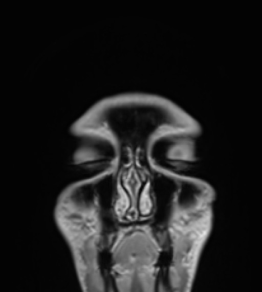 Click on the Serie image to view the images of RANDOM ANYONE