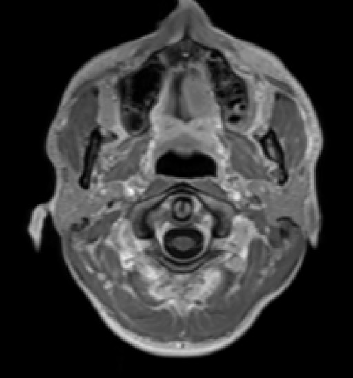 Click on the Serie image to view the images of RANDOM ANYONE