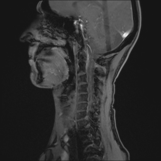 Click on the Serie image to view the images of RANDOM ANYONE