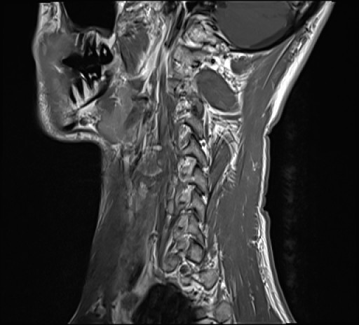 Click on the Serie image to view the images of RANDOM ANYONE